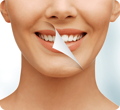 NE Calgary Cosmetic Dentistry | Monterey Dental Centre | NE Calgary Dentist